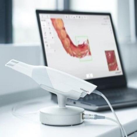Intraoralinių skenerių panaudojimas odontologijoje